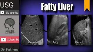 Liver normal echogenicity amp fatty liver with texture complete ultrasound lecture by DrFatima [upl. by Ethbinium]