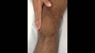 Knee Effusion Test  Selfassessment Swipe Test [upl. by Gillie740]