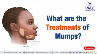 Mumps Treatments  What are the Treatments of Mumps  mumps [upl. by Froh]