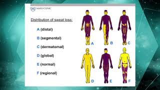 Thermoregulatory Sweat Test 7 of 16 [upl. by Varion521]