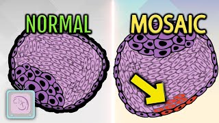 Successful IVF with mosaic embryo transfer [upl. by Eelyak665]