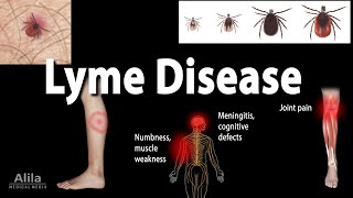 Lyme Disease Animation [upl. by Sankey]