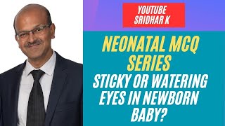 Sticky eyes in babies Nasolacrimal duct obstruction in babies Watering eyes in babies MCQ baby [upl. by Scoville]