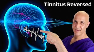 Tinnitus Reversed The Miracle of 1 Nutrient Dr Mandell [upl. by Nosecyrb]