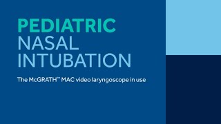 Learn How to Implement A Pediatric Nasal Intubation with Your Video Laryngoscope [upl. by Sayer]