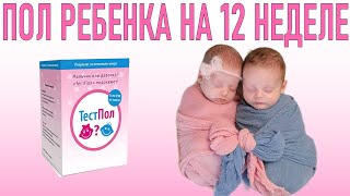 ПОЛ РЕБЕНКА НА 12 НЕДЕЛЕ БЕРЕМЕННОСТИ Когда можно узнать пол ребенка [upl. by Charla]