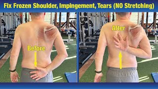 INCREDIBLE way to Fix Frozen Shoulder amp Impingement  NO Stretching or PT Exercises [upl. by Krischer]