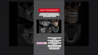 Importance of CBCT Radiographs in dentistry [upl. by Macgregor]