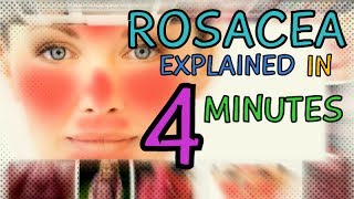 ACNE ROSACEA  ROSACEA EXPLAINED IN 4 MINUTES  TYPES OF ROSACEA  CAUSES  TREATMENT OF ROSACEA [upl. by Aikaj203]