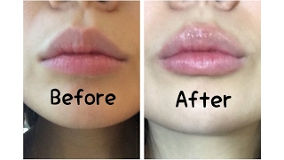 A lip plumper that actually works [upl. by Bailie]