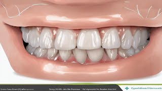 Restore Your Gum Health  What Are the Procedures for Periodontal Treatment [upl. by Enyleve]