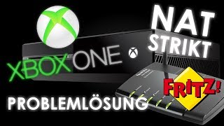 Xbox One  NAT Probleme beheben  Telnet Lösung  Fritz Box [upl. by Tareyn]