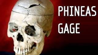 Phineas Gage A Song [upl. by Ronacin]