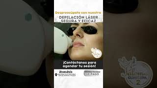 Depilación Láser para Bigote depilacionlaserdiodo depilacionlaser depilaciónláser hairremoval [upl. by Rocky]