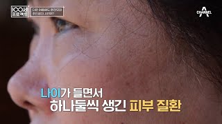 질병을 부르는 활성산소 활성산소 과다의 첫 번째 징후 피부를 주목하라  100세 프로젝트 140 회 [upl. by Ymmor]