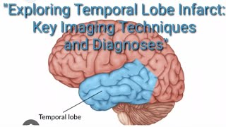 quotExploring Temporal Lobe Radiology Key Imaging Techniques and Diagnosesquot [upl. by Natfa331]