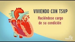 Viviendo Con La Taquicardia Supraventricular Paroxística TSVP Haciéndose cargo de su condición [upl. by Sitnalta377]