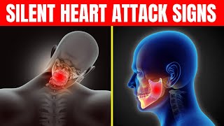 Top 10 Warning Signs Of Silent Heart Attack You Should Not Ignore [upl. by Gelya291]