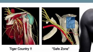 Tips for Basic Shoulder Arthroscopy Part 2 Diagnostic Routine [upl. by Liane943]