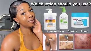 THE BEST BODY LOTIONS FOR UNEVEN SKIN  BODY ACNE  BUMPY SKIN  Fast working lotions‼️ [upl. by Lirbaj8]