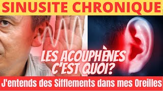 Jentends des Sifflements dans mes Oreilles Acouphènes Que faire Voici Comment sen Débarrasser [upl. by Eatnhoj]