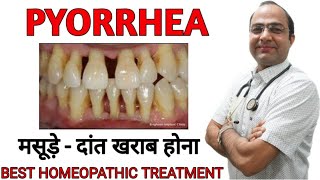 Pyorrhoea । जिंजिवायटिस । gingivitis । gums ।हैलिटोसिस [upl. by Euphemia]