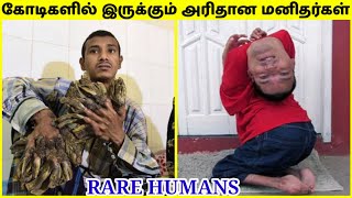 விசித்திரமான மனிதர்கள்  Rare Humans That Are One In A Million in Tamil  TAMIL AMAZING FACTS [upl. by Center753]