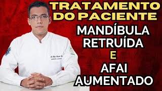 Como tratar AFAI aumentado e mandíbula retruída com Classe II  Parte 1 Aula 177 [upl. by Faith]