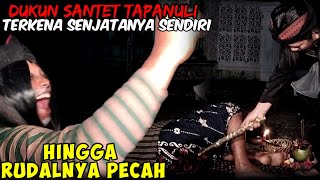 TELOR DUKUN INI PECAH KONEKNYA MEMBENGKAK TAK SANGGUP MENAHAN SERANGAN ILMUNYA SENDIRI [upl. by Amein]