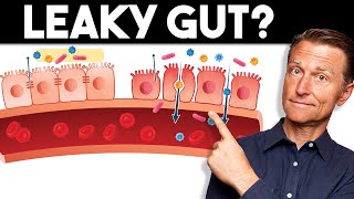 7 Signs of a Leaky Gut — Dr Berg [upl. by Roland]