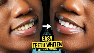 How to WHITEN TEETH in Photoshop  Easy Retouching Tutorial [upl. by Gnad]