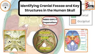 OSPE Preparation Identifying Cranial Fossae and Key Structures in the Human Skull  Dr KS Academy [upl. by Chiou]