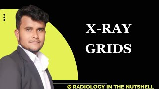 What is Grid  Xray grids  Grids kya hotta hai types of grids Grids in Radiology  Radiation [upl. by Bilek558]