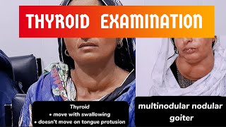 Examination of Thyroid with interpretation thyroid goiter examination hospital Abdulwahid [upl. by Valdas]