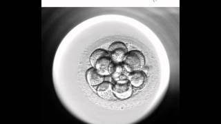 Embryoscope 2  Nuevo método de cultivo y selección embrionaria [upl. by Ulane94]