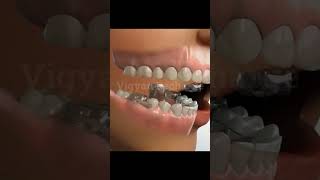 Jaw Treatment teeth dentist health [upl. by Swor]