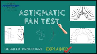 Astigmatic Fan Test Detailed Procedure and Principle Explained [upl. by Nnylanna]