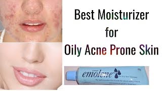 Top Moisturizer for Oily and Acne Prone skin  Emolene Cream  Angel Secrets [upl. by Haret]