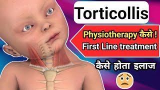 torticollis  torticollis treatment  torticollis in hindi  torticollis brace torticollis [upl. by Esojnauj]