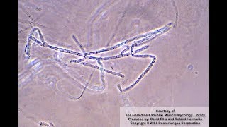 Microsporum ferrugineum identification [upl. by Ennayehc]