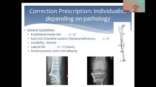 Periarticular Osteotomy for Knee Pathology  Indications Techniques amp Outcomes Dr David Parker [upl. by Pontus724]