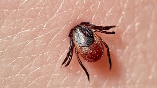 How To Remove a Tick [upl. by Lurlene520]