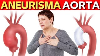 Aneurisma de Aorta Causas Riesgos Como evitar los Aneurismas [upl. by Ashraf]