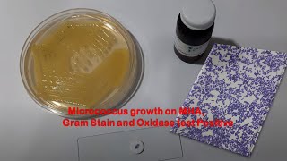 Micrococcus growth on MHA Gram Stain and Oxidase test Positive [upl. by Lothar332]