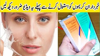 Dont Use This Cream Before Watching This Video  Clobevate Cream uses in UrduHindi [upl. by Reneta]