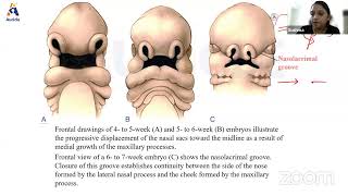 Auricles Anatomy Live Class on Embryology of Face amp Palate by Dr Sushma [upl. by Hanikahs]