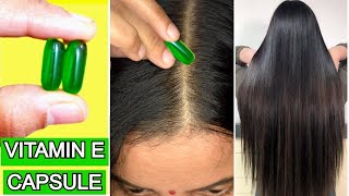 इस तरह लगाए Vitamin E Capsule बालो को तेजी से बढ़ाने के लिए Vitamin E For Hair Growth Tips [upl. by Ordnasil537]