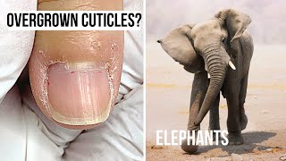 What Do Elephants amp Overgrown Cuticles Have In Common [upl. by Timothea64]