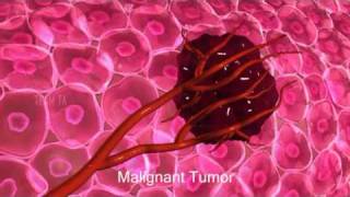 Cancer Growth Animation [upl. by Narba493]