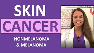 Skin Cancer Basal Squamous Cell Carcinoma Melanoma Actinic Keratosis Nursing NCLEX [upl. by Nagiem630]